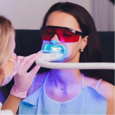 teeth-whitening-in-woodland-hills teeth-whitening-in-woodland-hills