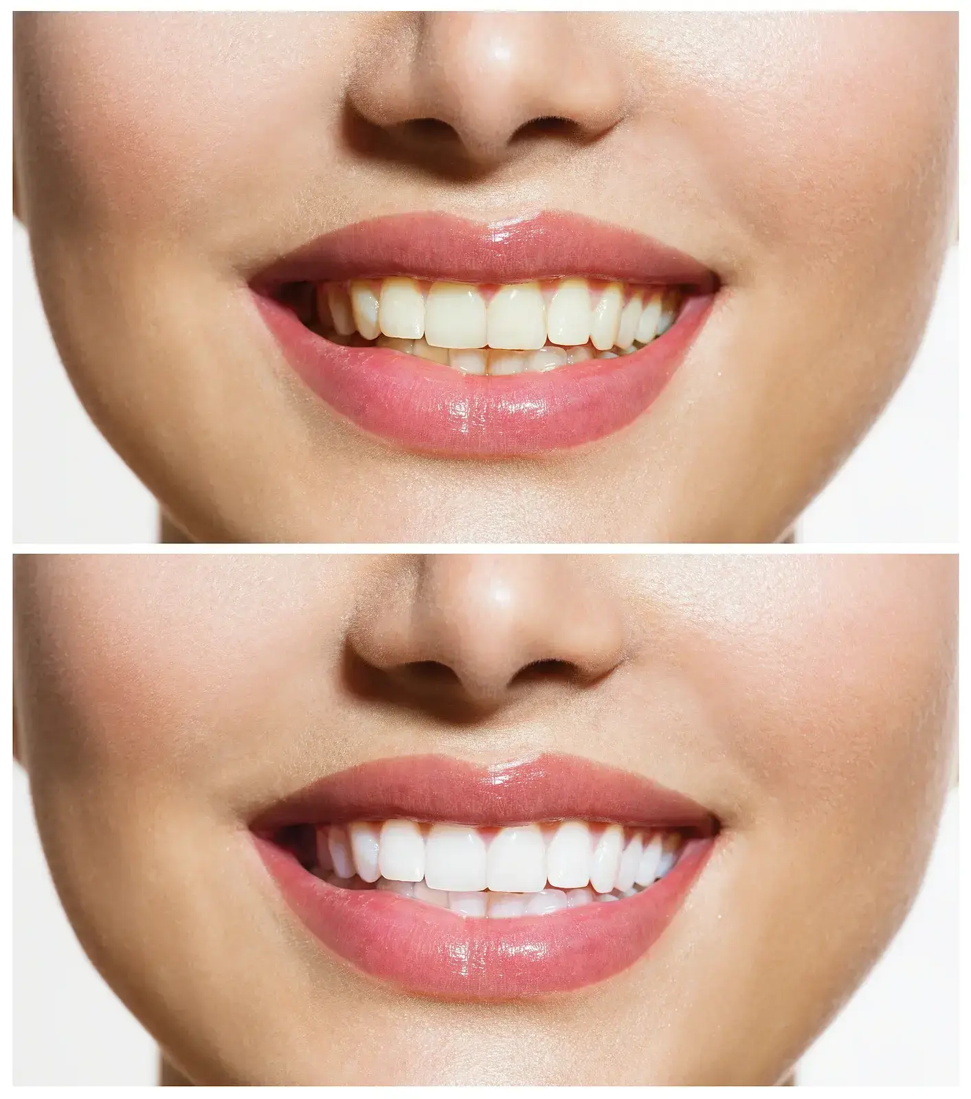 before After image before After image