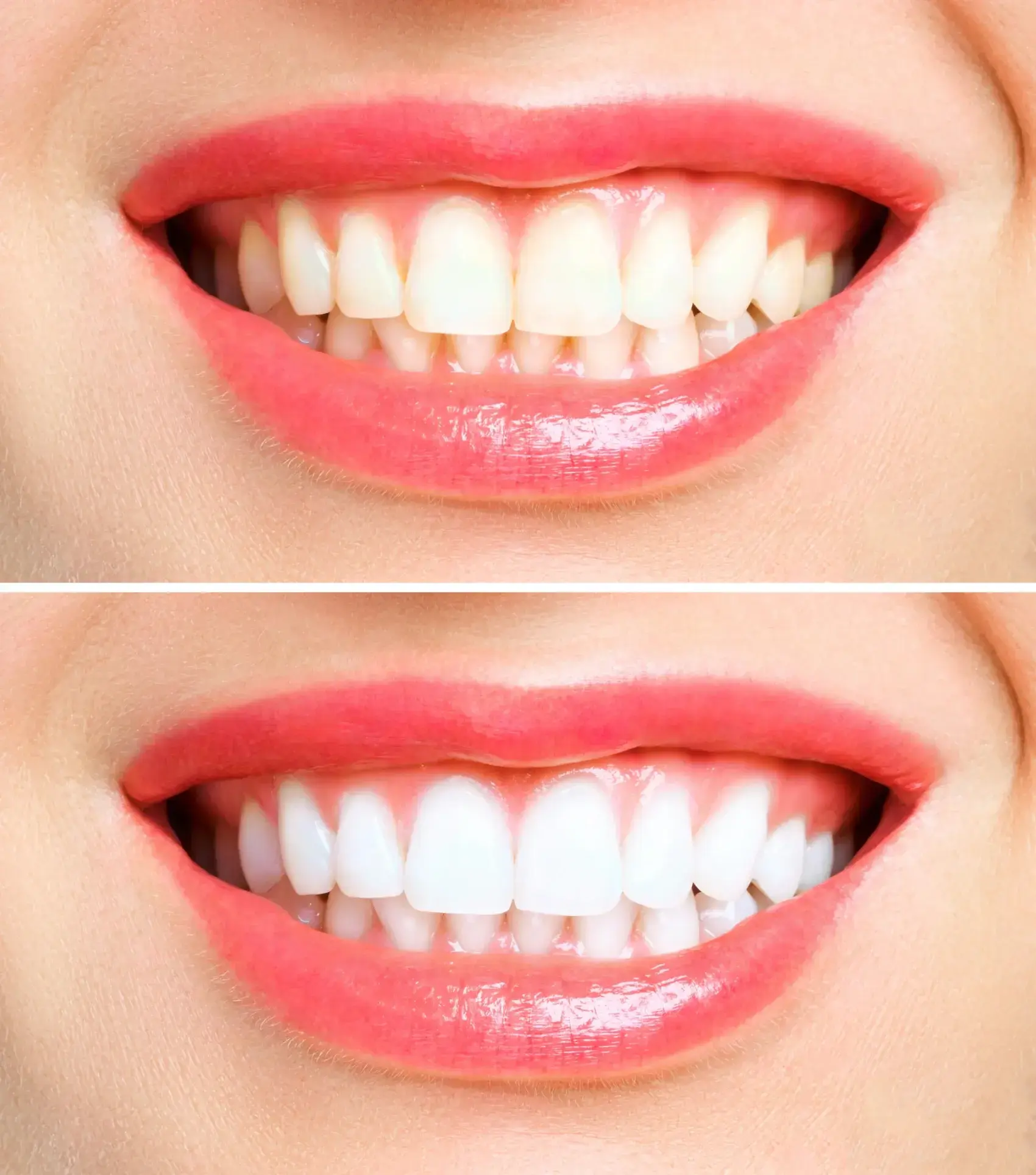 before After image before After image