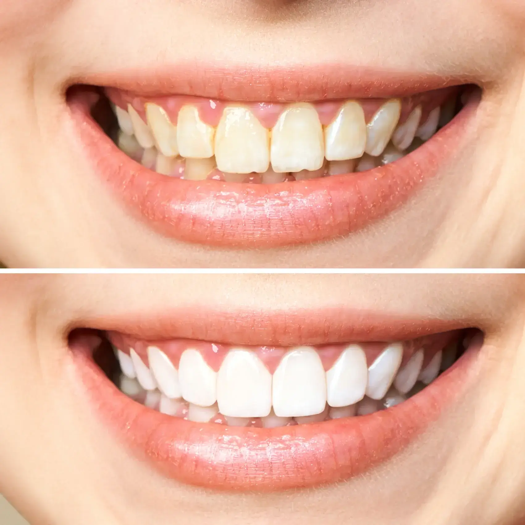 before After image before After image